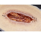 ClinicalWound_stitches-web