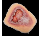 CS-008_Venous_Wound_Med