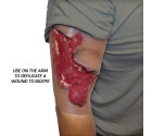 Avulsion_Calf_Dark_inUSEarm copy