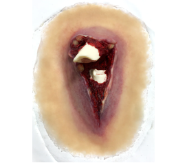 sw013_compound_fracture_1800x1800