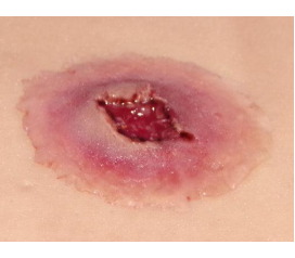 GSW-entry-Large_1800x1800