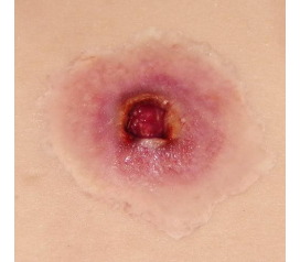 GSW-entry-small_1800x18001