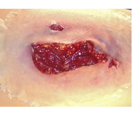 LacerationLarge2_1800x1800