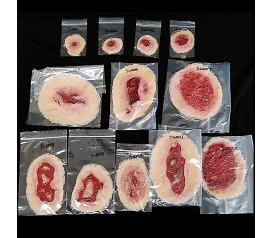 SW000-SelfAdhesiveWoundsKit_LT