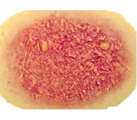 Burn2ndDegree_1800x1800