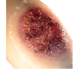 Thermal-Burn-Large_1800x1800