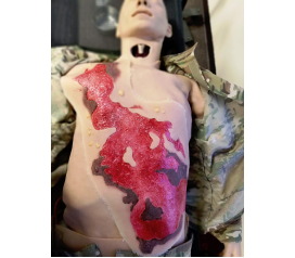 SW019_3degreeChest_debrided