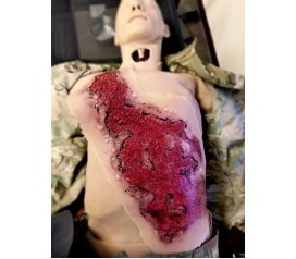 SW018_3rdDegree_ThermalChestBurn