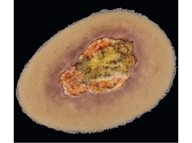 CS-007_Arterial_MEDIUM