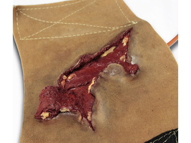 009_CalfAvulsion_DarkTone_b