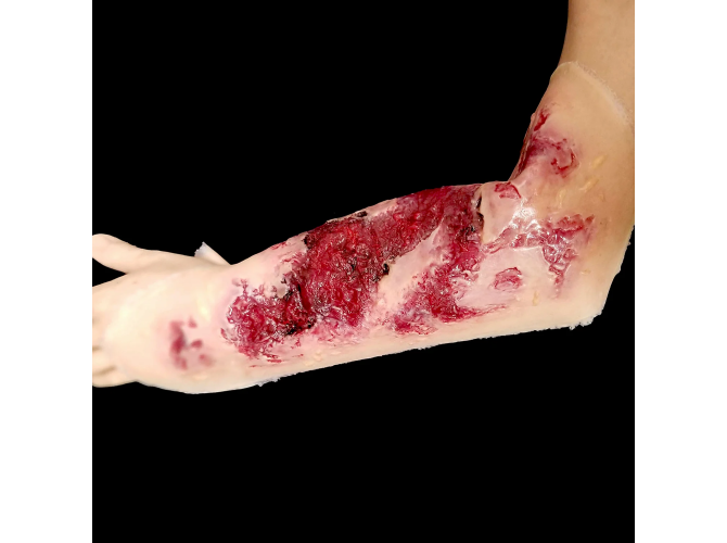 SW016_3rdDegree_ThermalBurnARM_LT-2_1800x1800