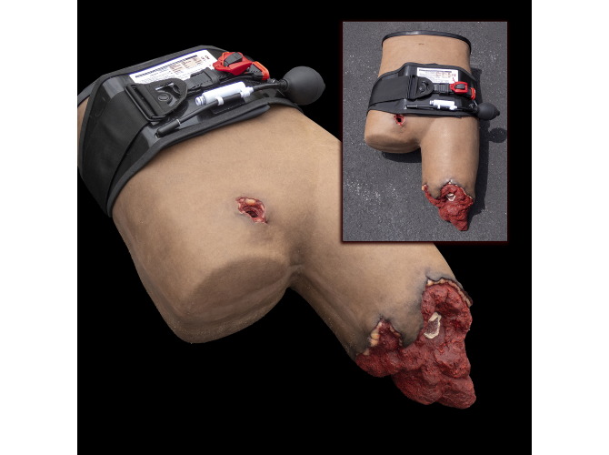 B80_AAJT-S_Abdominal-Inguinal