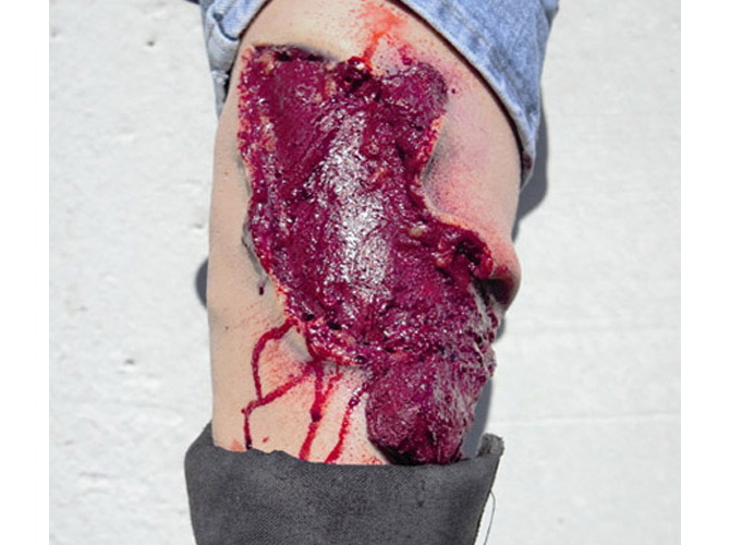 009_CalfAvulsion_Light2