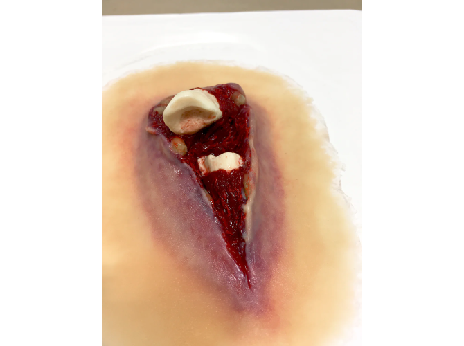 sw013_compound_fracture_1_1800x18002