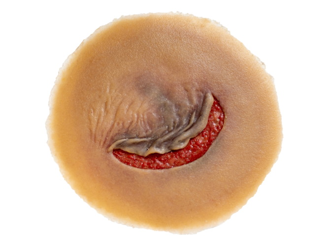 CS009_SkinTear_MEDIUM