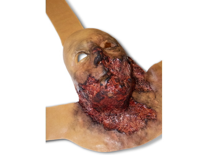 011_BurnFace_mediumSkinTone1