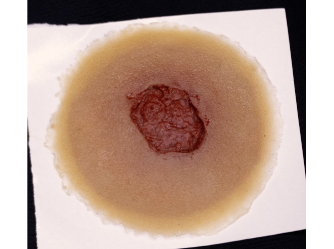 CS-006-InfectedWoundOnBacking_Medium