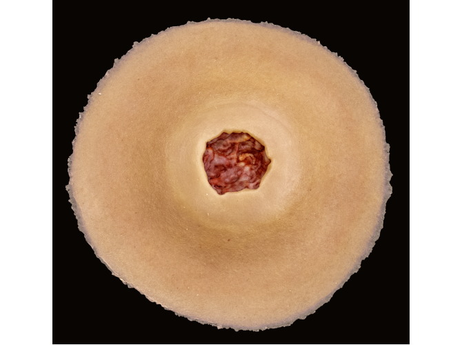 CS-009_DiabeticUlcer_Medium