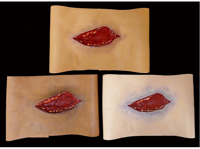 001_Lacerations_3SkinTone_1