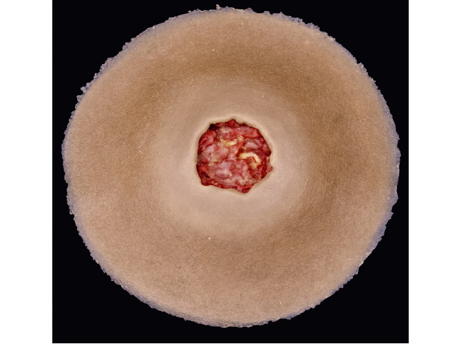 CS-009_DiabeticUlcer_Dark