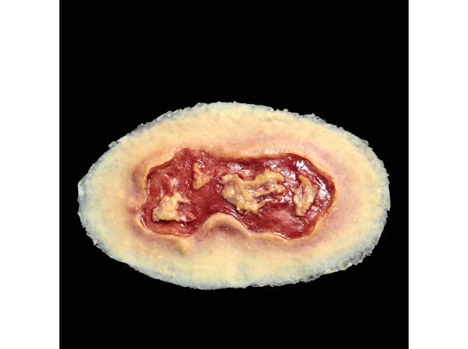 SW008_Electrical_Burn_Medium_3aaca09b-81d9-444f-8a79-9facf5cfb4f5_1800x18002