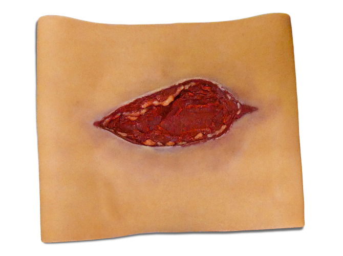 001_Lacerations_MEDIUMSkinTone