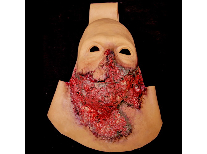 011_BurnFaceMEDIUMSkinTone