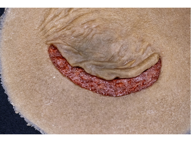 CS011Clinical_Sticky_SkinTear-FLAP_Dark3Web