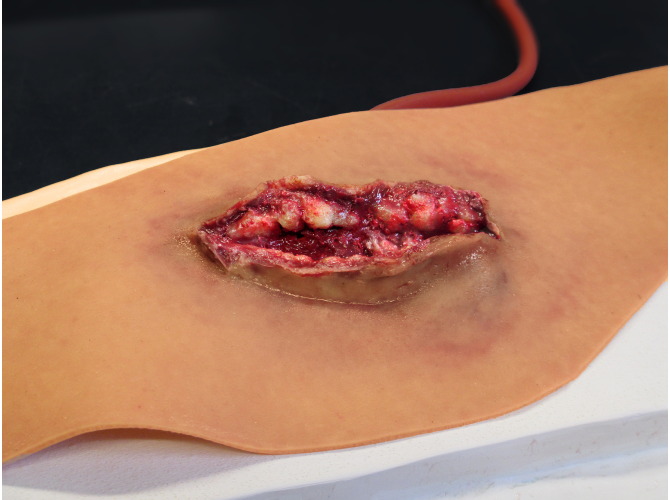 014_Neck_Laceration_MEDIUM