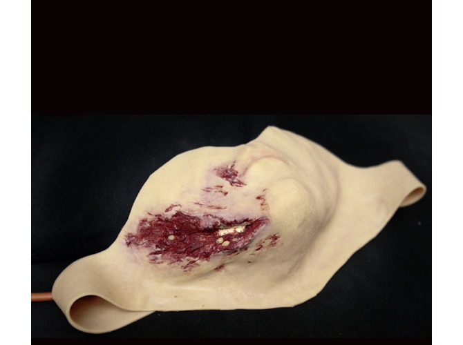 006_jawLaceration_light_2