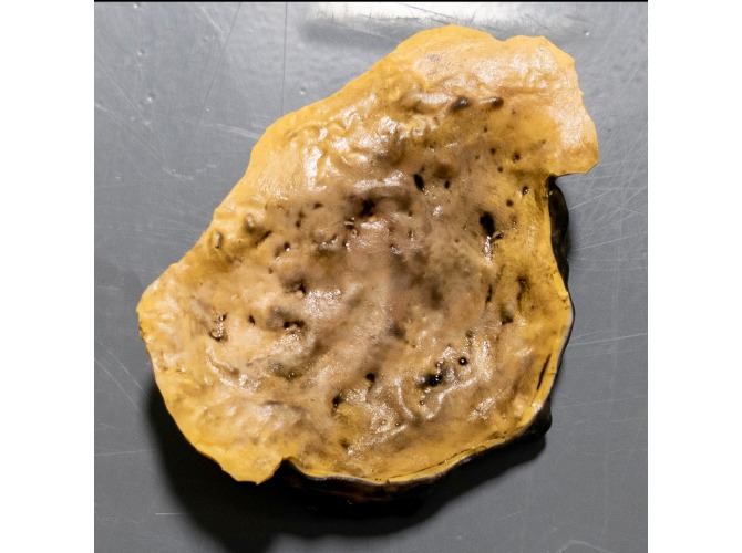 CTS-UP4_unstageable_PLUG