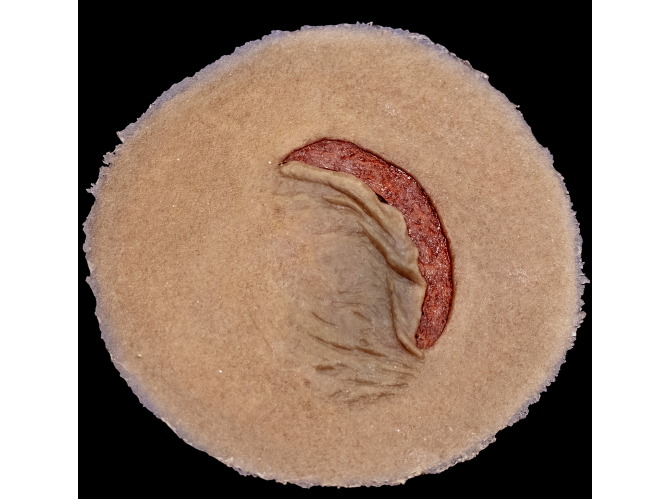 CS011Clinical_Sticky_SkinTear-FLAP_DarkWeb