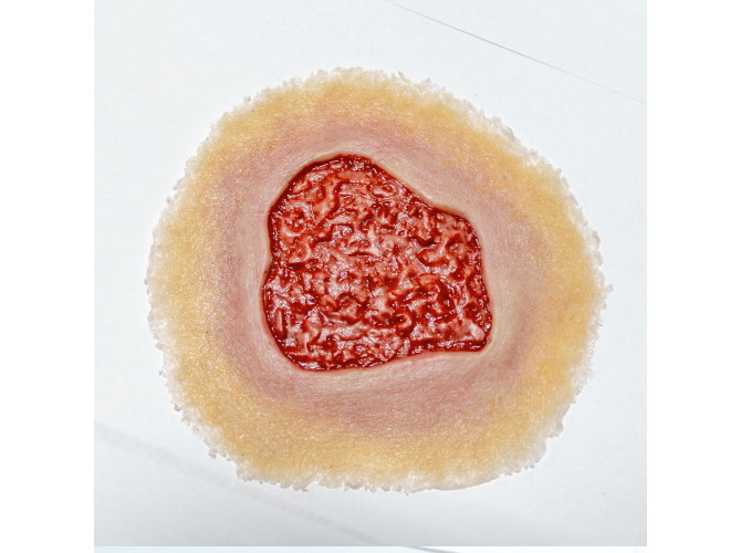 Granulation_SelfAdhesive_LT