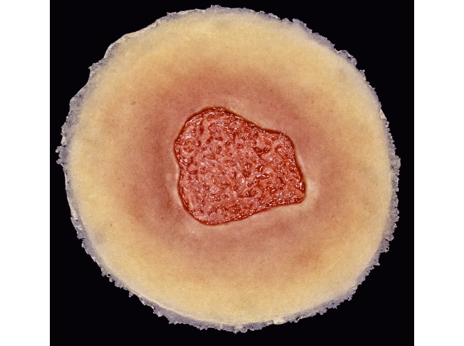 013-Granulation_SelfAdhesiveMED1