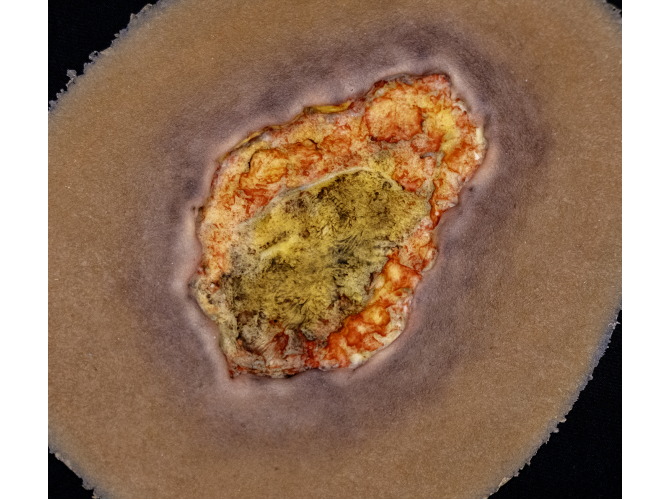 CS-007_Arterial_DARK1