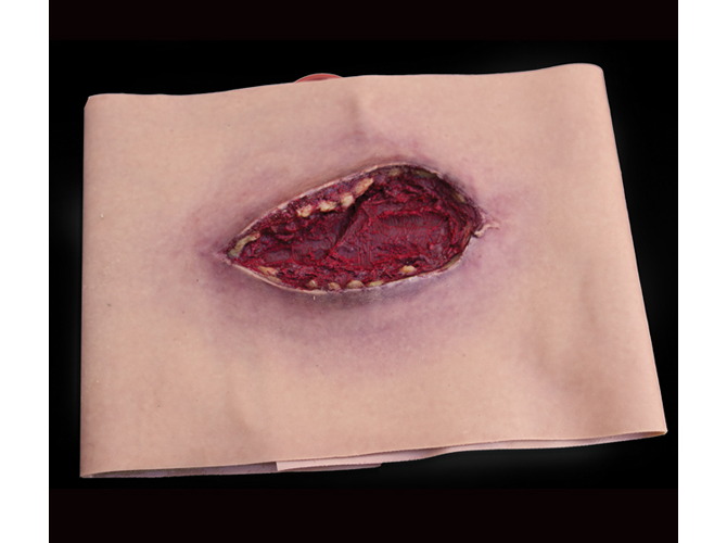 001_ThighLacerationLT_primary