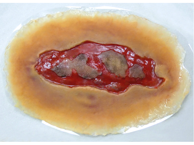 SW011_ElectricalBurnLarge_MediumSkin_sm_1800x18004