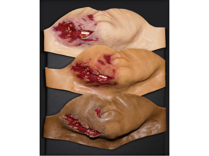 006_JawLaceration_3SkinTones1