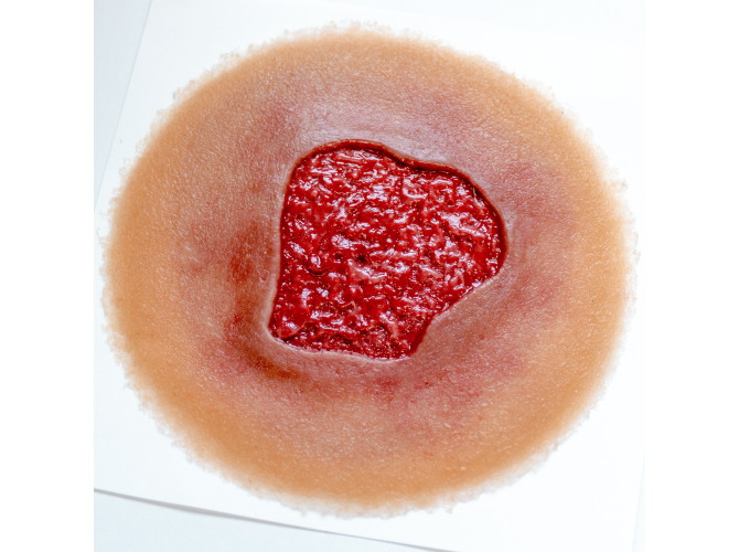 Granulation_SelfAdhesive_MED2