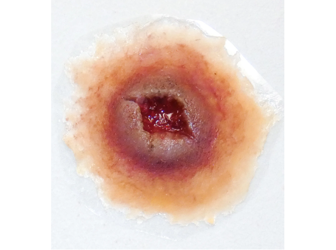 SW002GunshotEntryLarge_MediumSkin_1800x18004