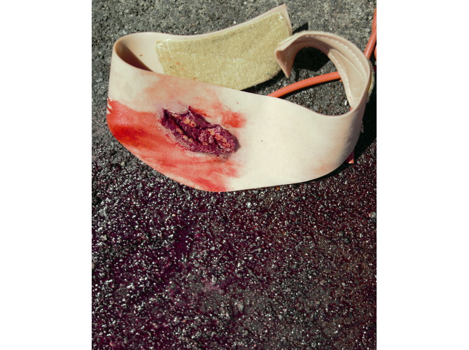 014_Neck_Laceration_Light