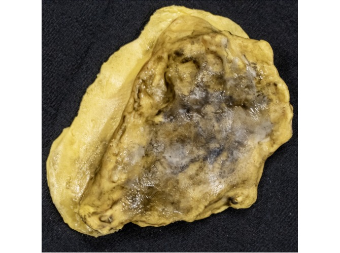 CTS-UP4_unstageable_PLUG_forST4Under