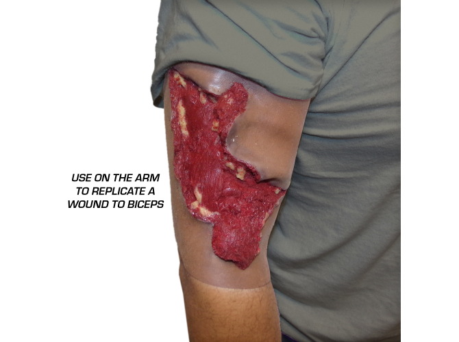 Avulsion_Calf_Dark_inUSEarm copy