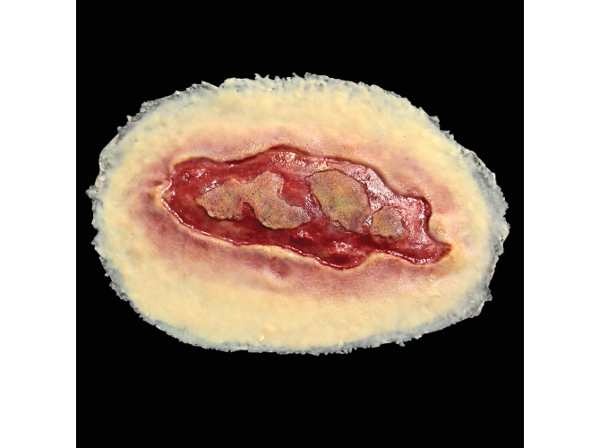 SW011_Electrical_Burn_Large_148d93a0-66b6-46bc-9438-0d1991ce1bb2_1800x18003