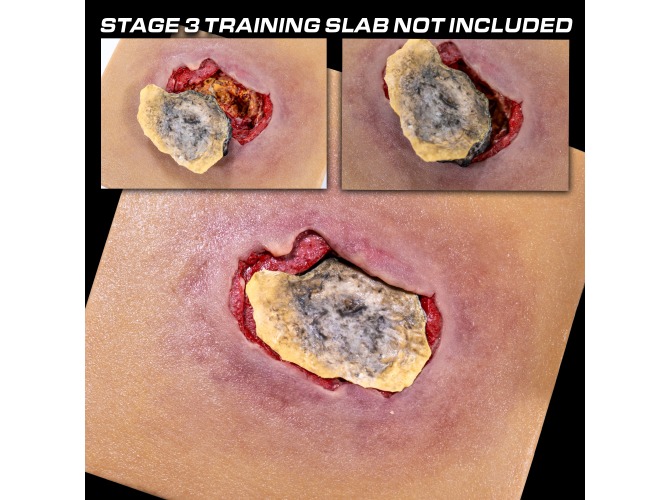 unstageable_PLUG_HowTo