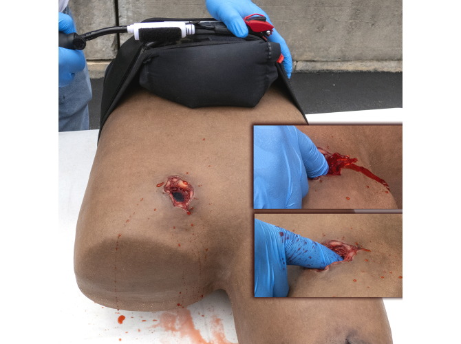 B80_AAJT-S_Abdominal