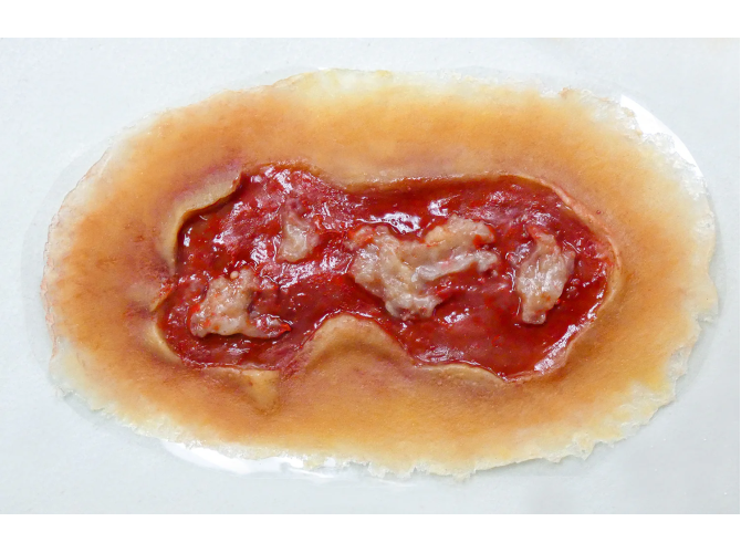 SW008_ElectricalBurnMed_MediumSkin_sm_1800x18003