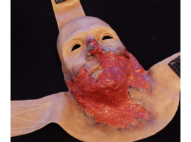 011_DarkSkinToneBurnFace