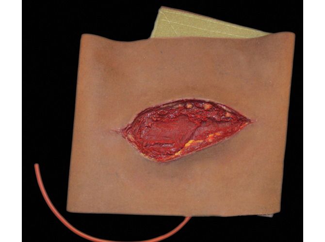 001_ThighLacerationDark3