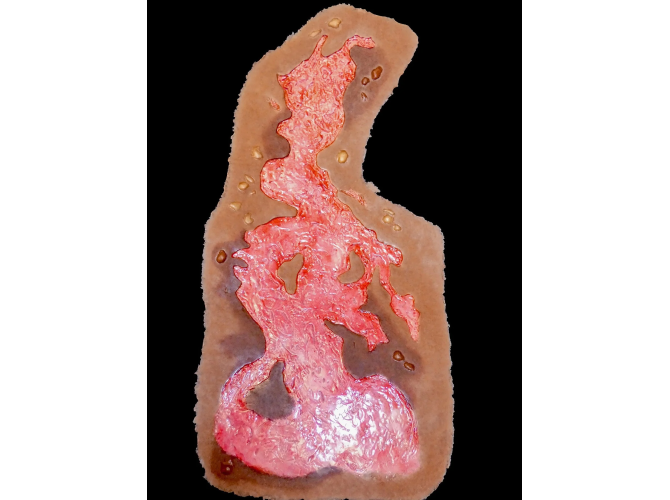 sw019_3degreeChest_debrided_DK_2_1800x18002